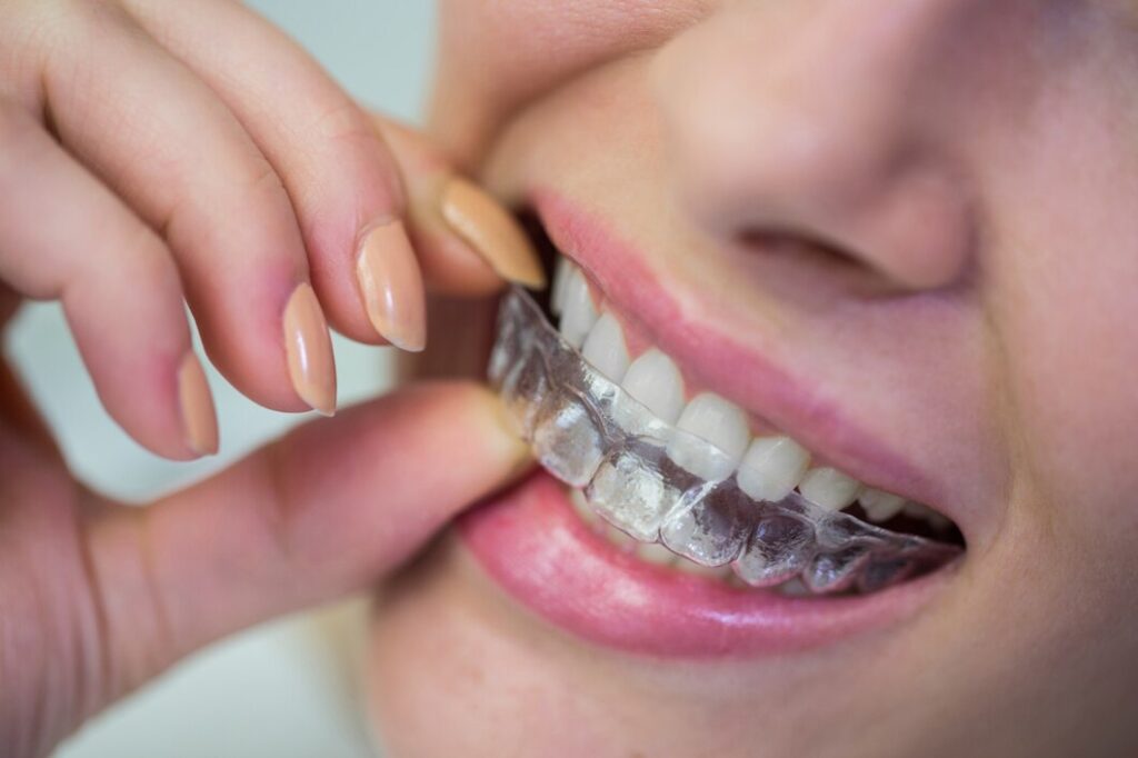 Oral Appliance Therapy