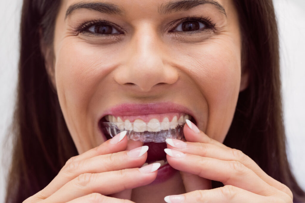 Anti-Snoring Mouthpiece